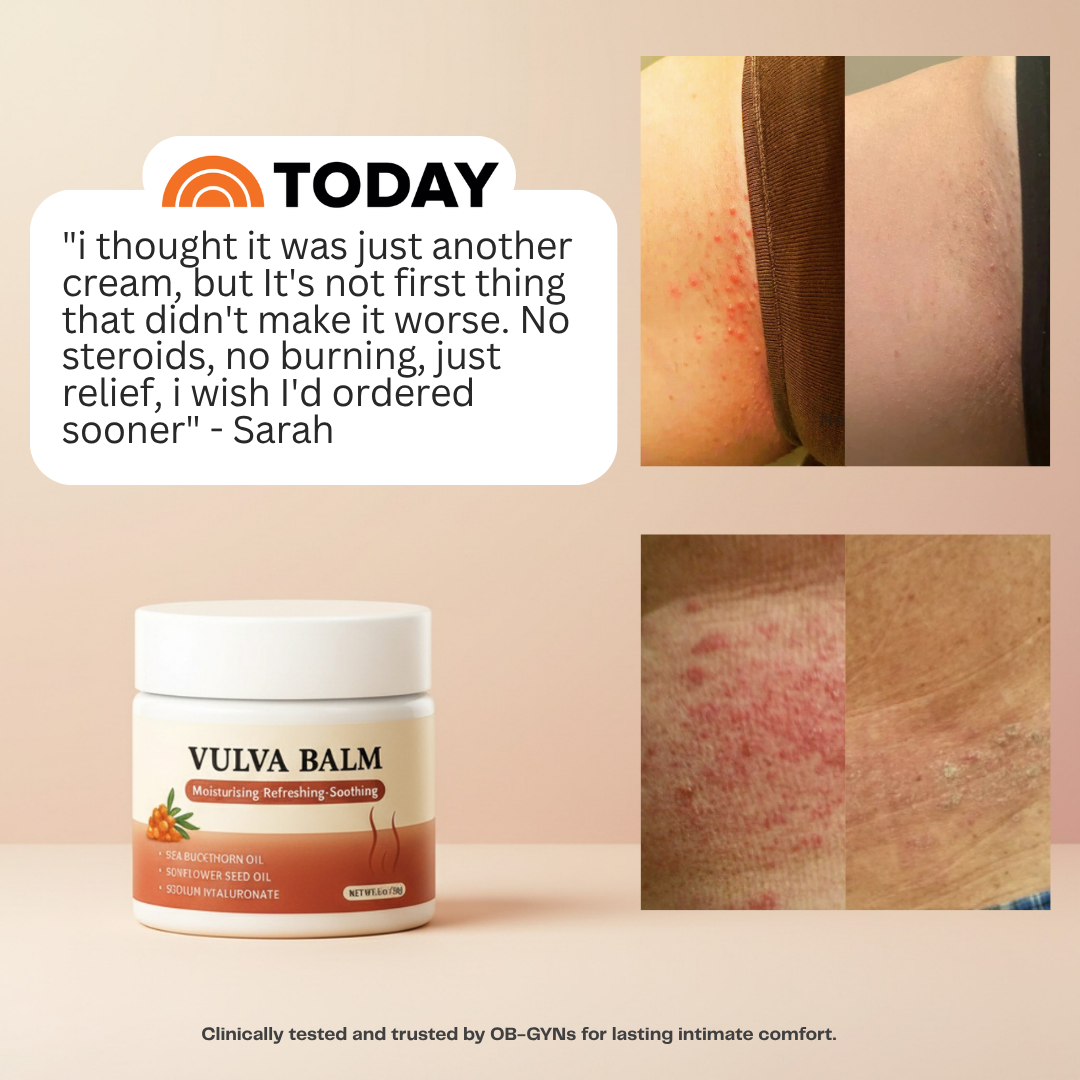 NightSkin™ Relief Balm — Night-Time Care for Itching, Burning & Dryness